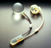 Artificial Sphincter Pic