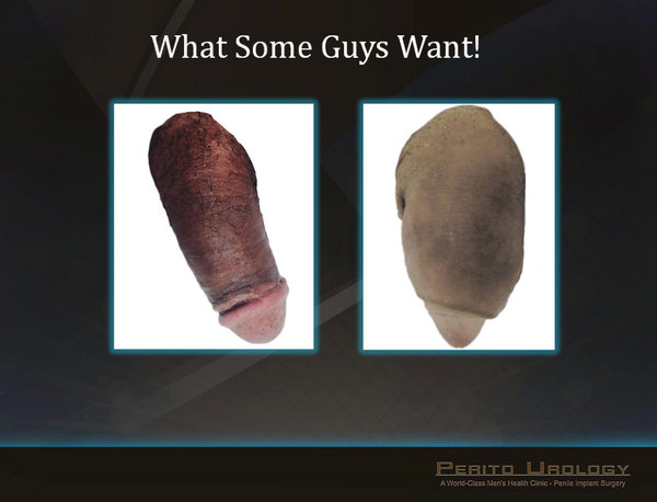 girth-11