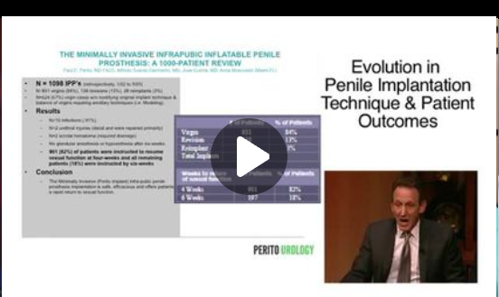 Ongoing Development with the Perito Implant